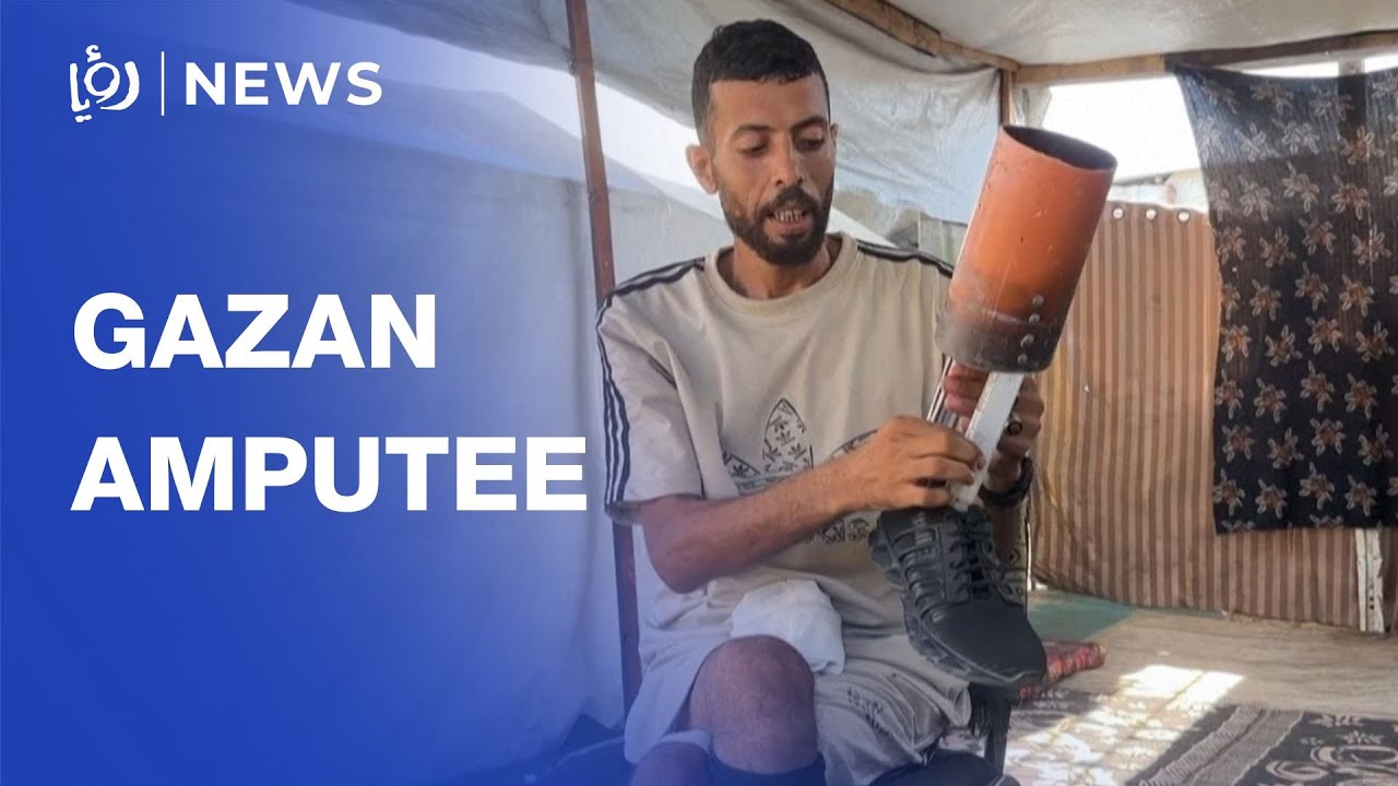 Gaza amputee makes prosthetic leg after aid site injury