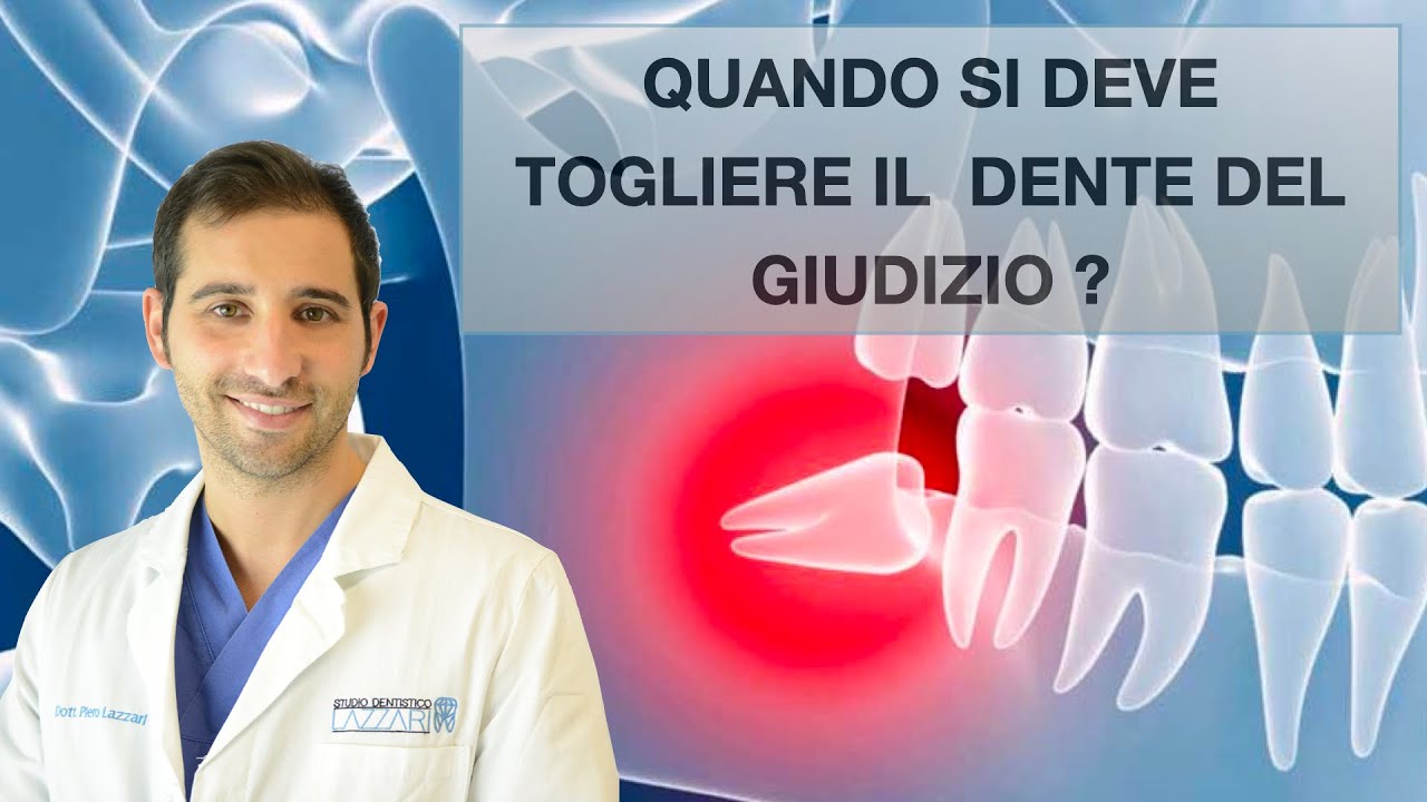 Dente del giudizio. Quando si toglie?