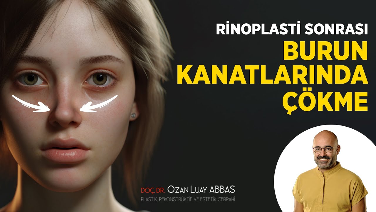 Rinoplasti Sonrası Burun Kanatlarında Çökme | Doç. Dr. Ozan Luay ABBAS