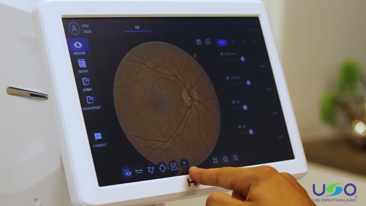 Fondo de ojo - Tomografía de coherencia óptica con Fundus HOCT Huvitz - US Ophthalmic