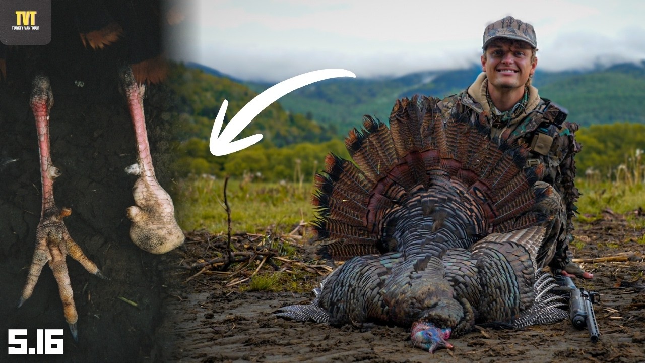 WHAT is WRONG with this Turkey's FOOT?! - The Final TVT'25 Video