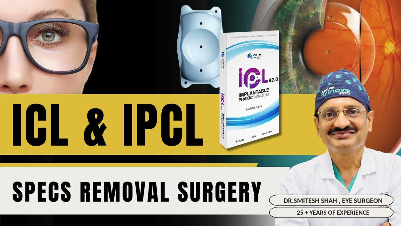 Upgrade Your Vision: ICL & IPCL Lens Options Explained by Dr. Smitesh Shah