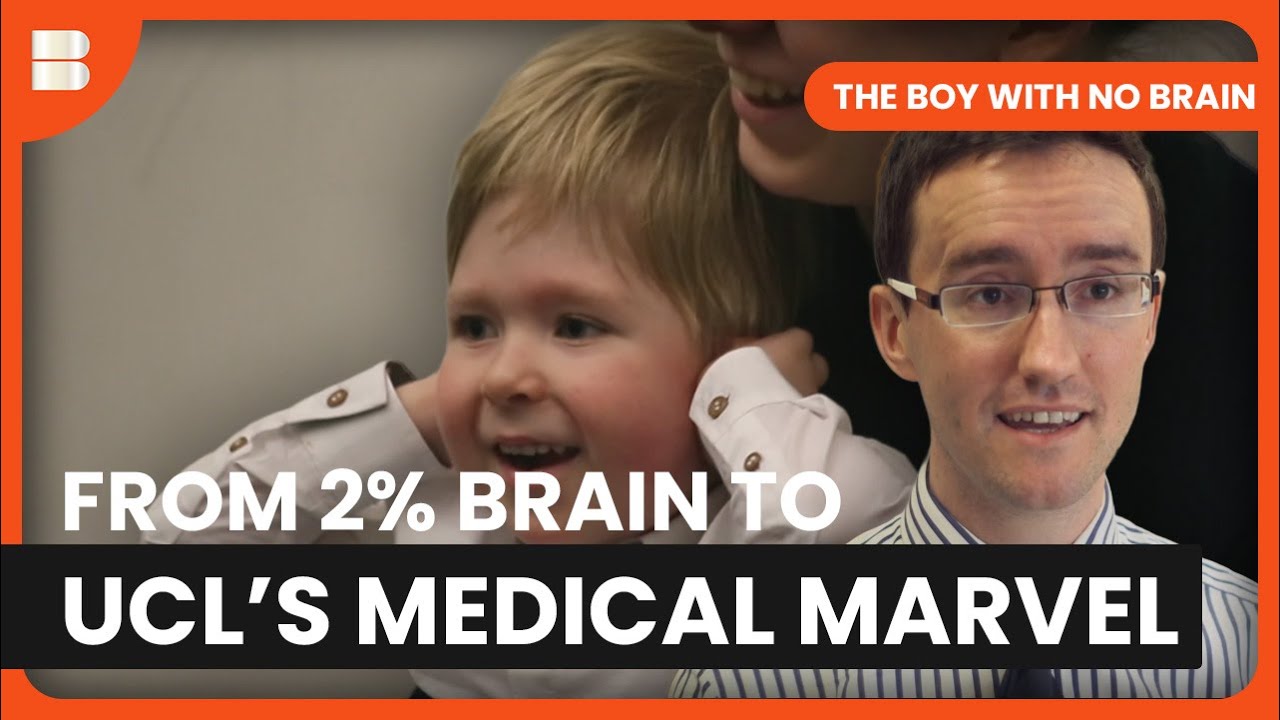 Noah’s Journey: From 2% Brain to UCL Medical Marvel | The Boy With No Brain | Medical Documentary
