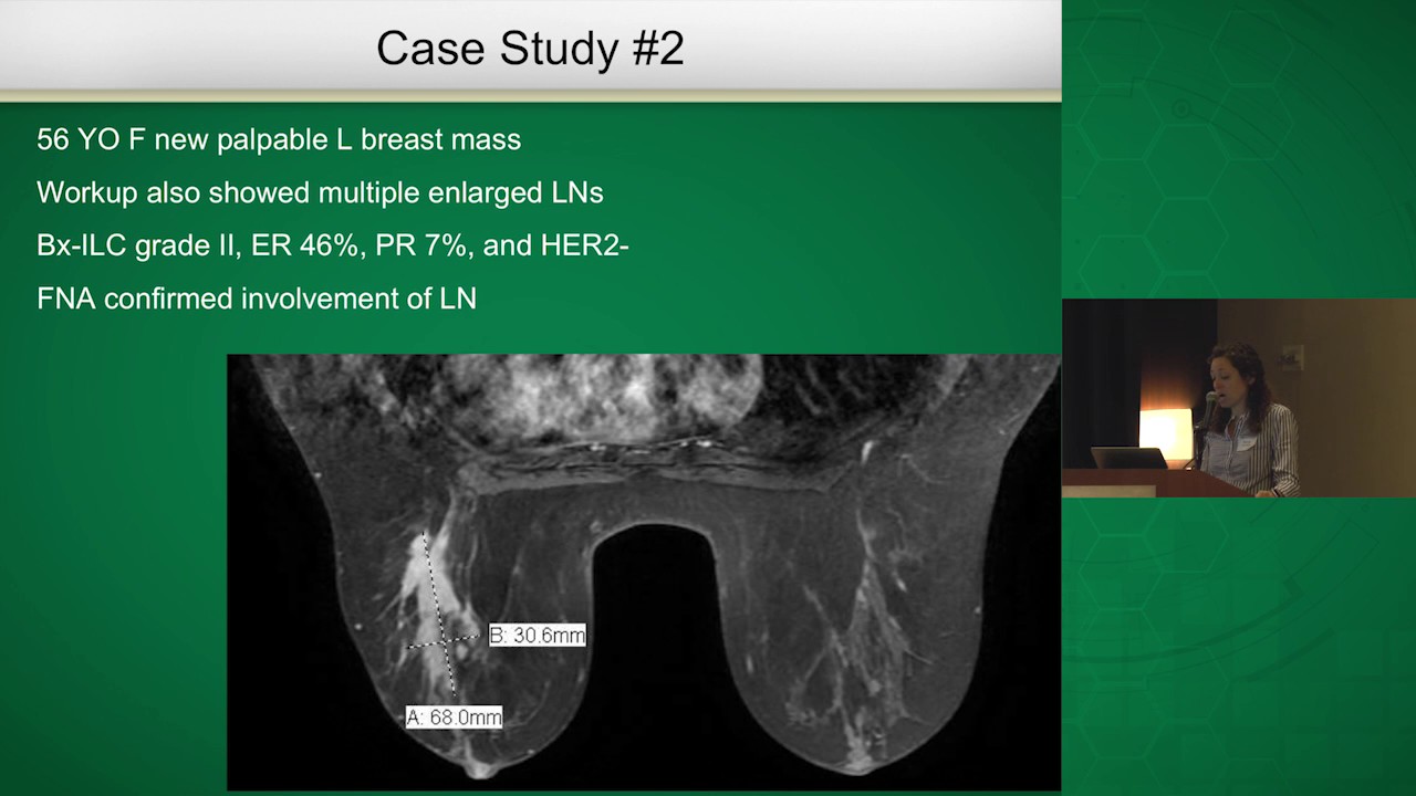 Breast Cancer Surgical Margins