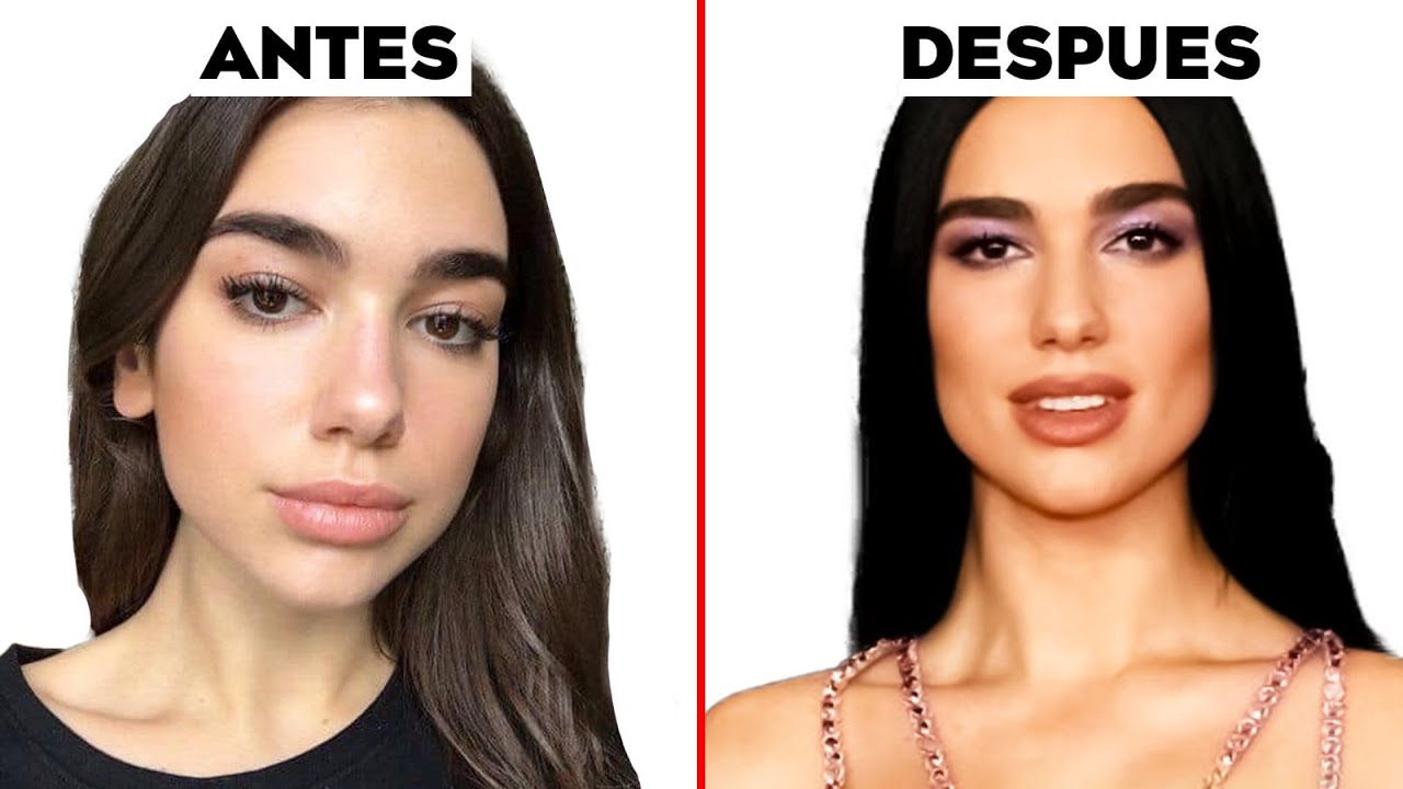 Dua Lipa y su nuevo rostro ¿Qué cirugías estéticas se hizo?