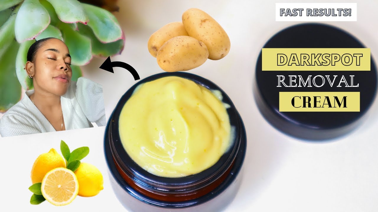 GET FLAWLESS SKIN WITH THIS LEMON AND POTATO BUTTER CREAM DIY: Lightening cream