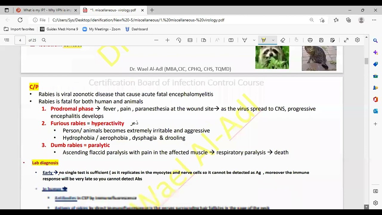 Rabies virus (Rhabdoviridae family - Lyssa virus genus )