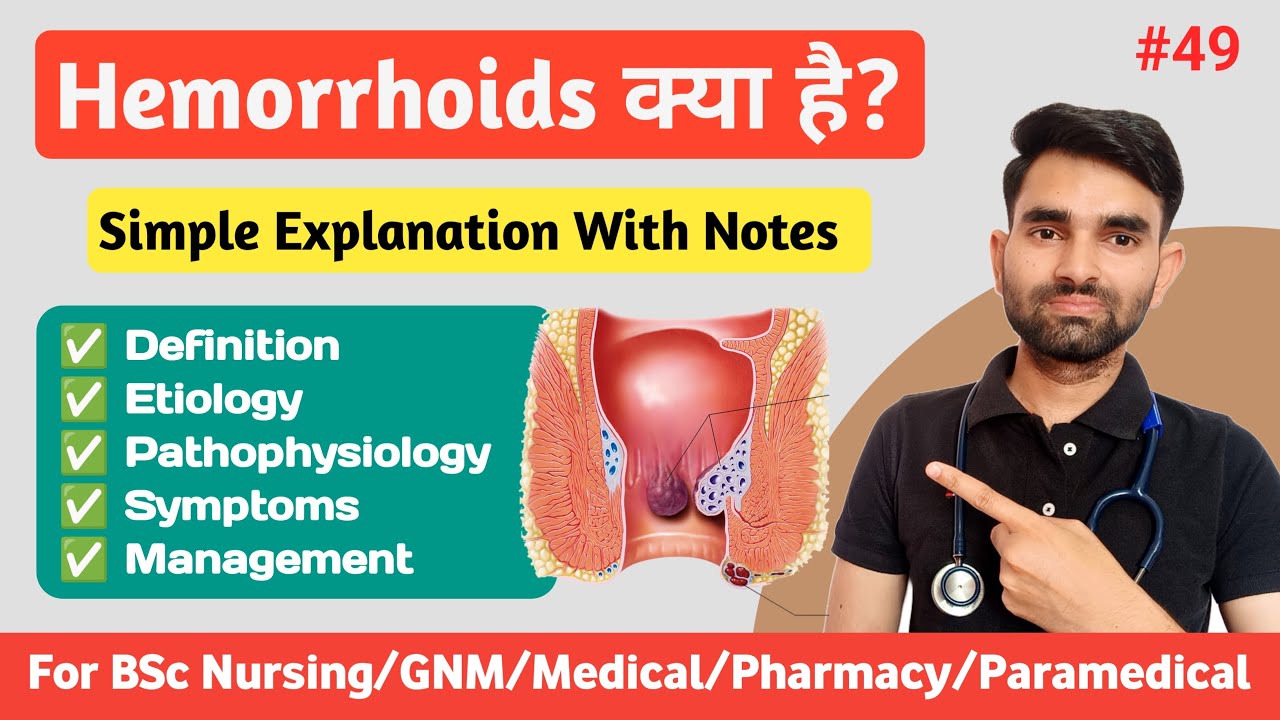 Hemorrhoids in Hindi | Types, Causes, Pathophysiology, Symptoms And Management of Hemorrhoids