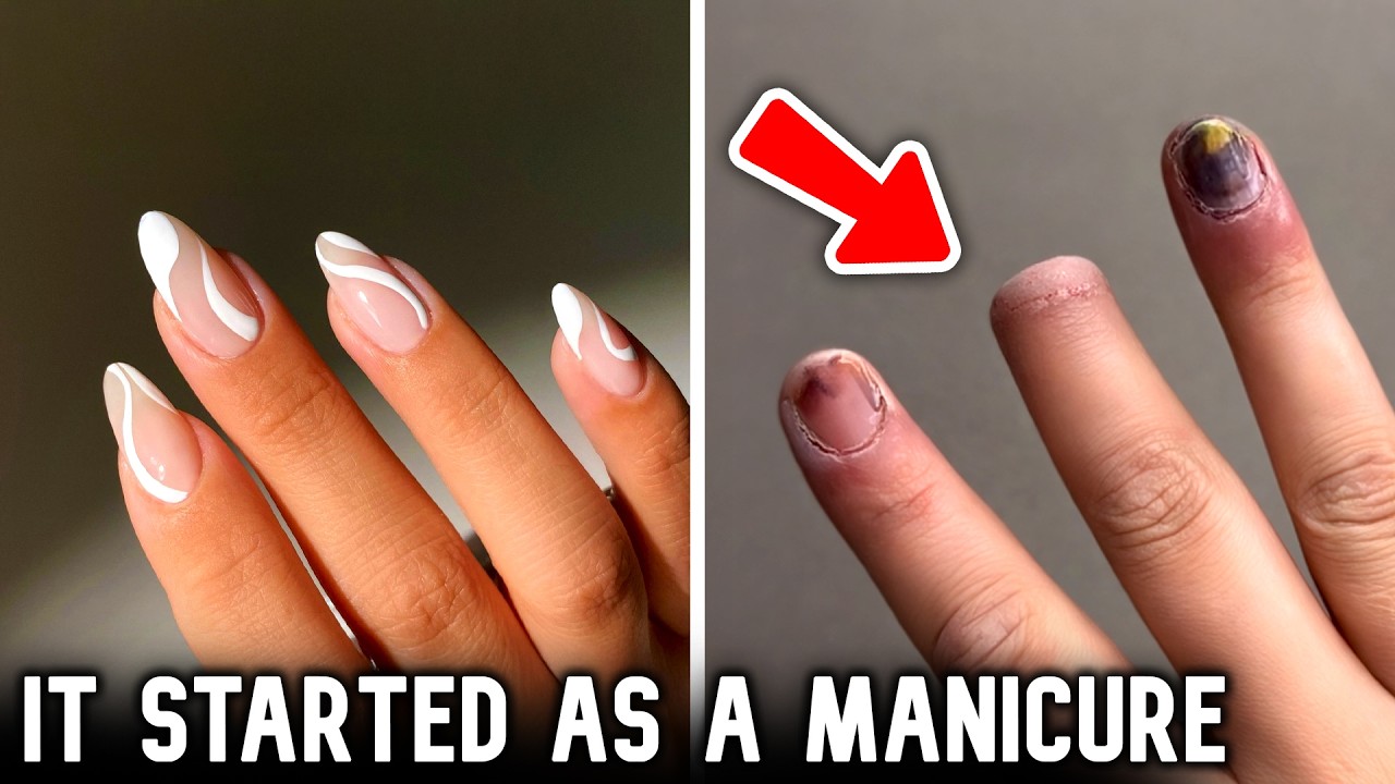 How These Manicures Are Ending in Amputations