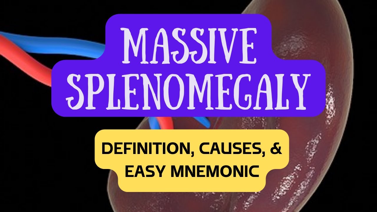 Massive Splenomegaly (Enlarged Spleen) : Definition, Causes and Easy Mnemonic