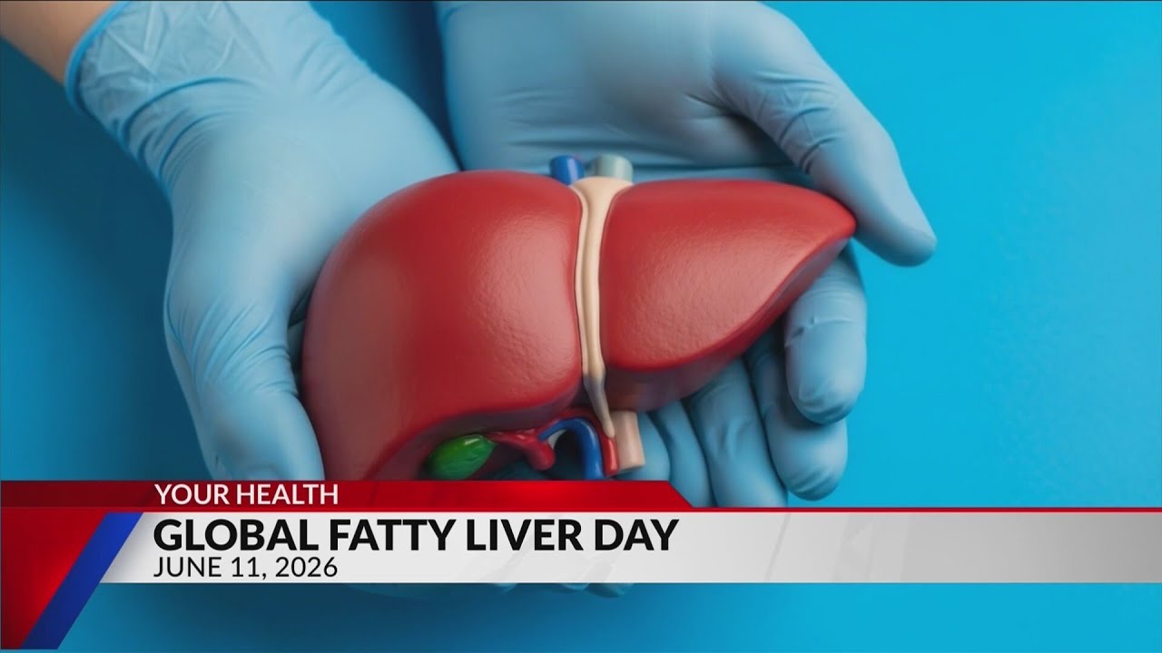 Global Fatty Liver Day: What You Need To Know -- In A Studio Conversation