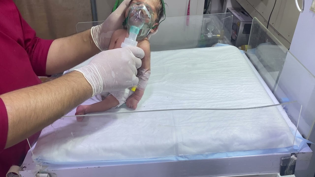 Adorable Down Syndrome Baby in NICU | Wheezing & Nebulizer Support