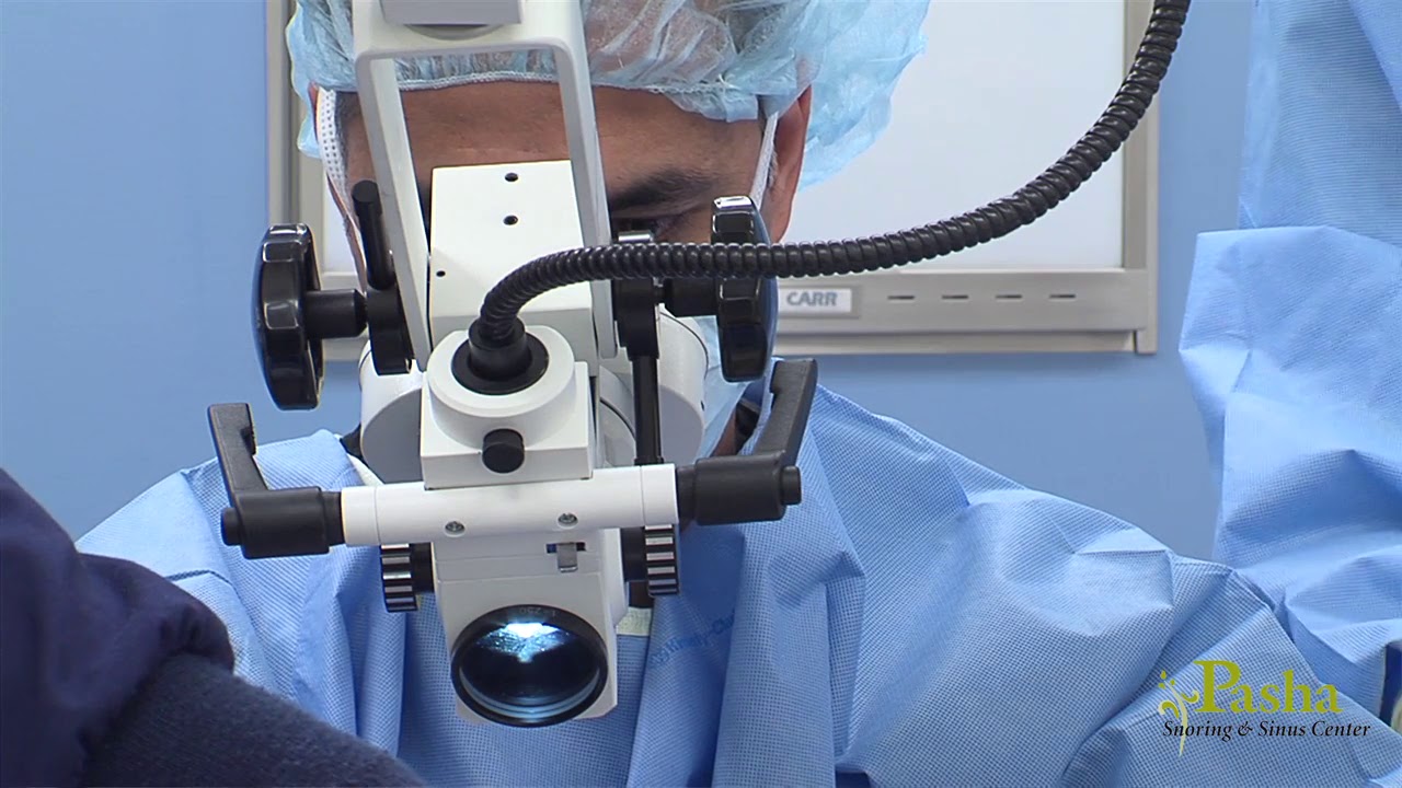 What is Palatal Reconstruction? Snoring & Sleep Apnea Surgery