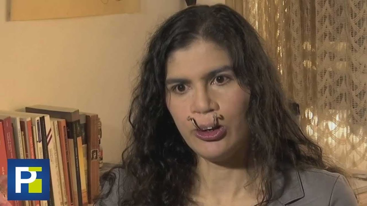 La angustia de una mujer que se quedó sin trabajo porque tiene dificultades para hablar