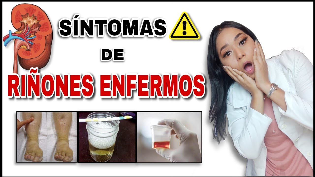 SEÑALES que Indican que tus RIÑONES están ENFERMOS😨 | Signos y Síntomas de Enfermedad Renal.