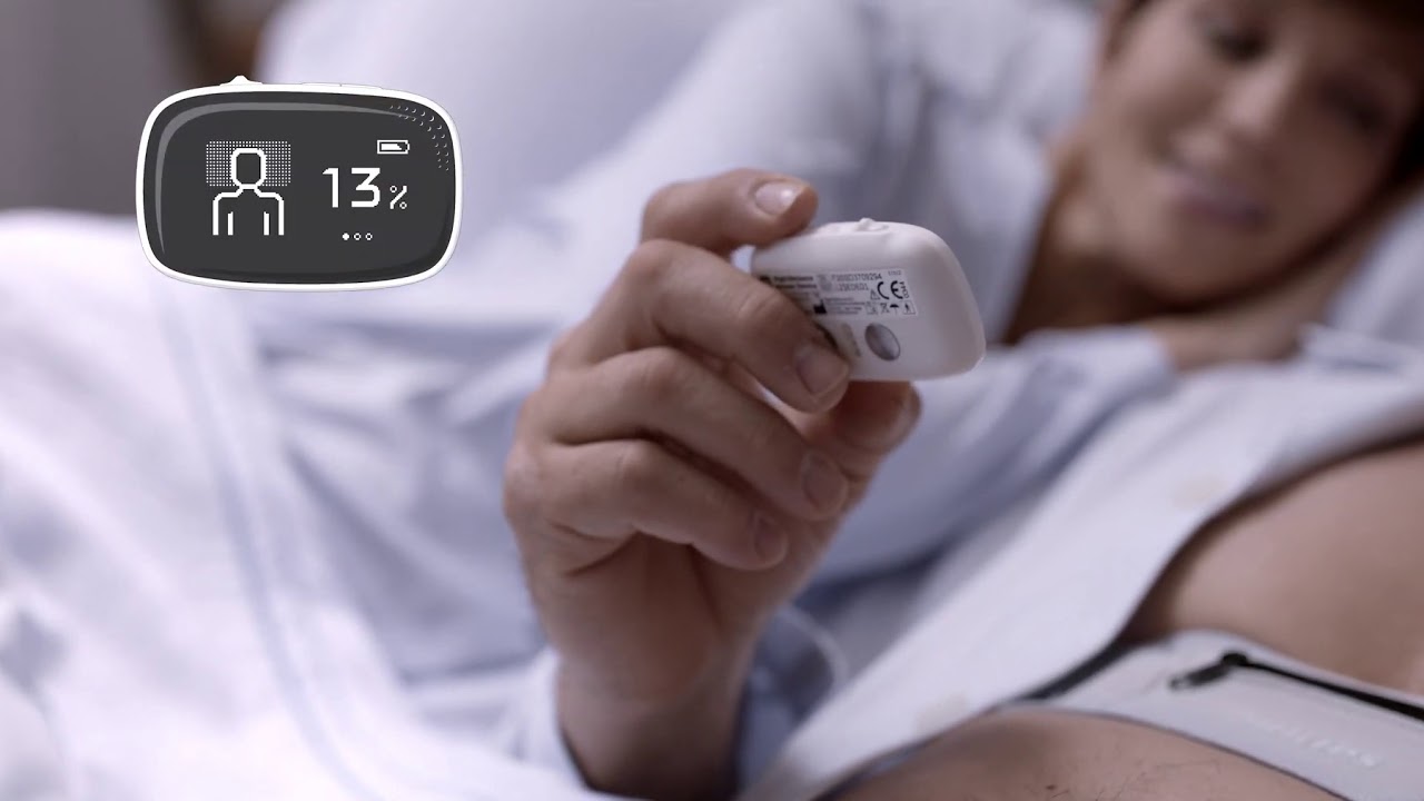 Getting the Most Out of Philips NightBalance Positional OSA Device