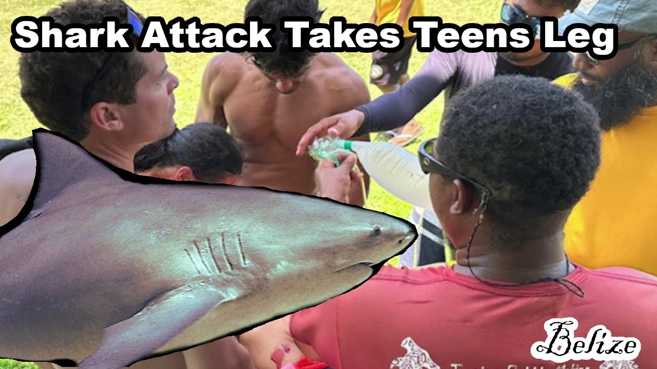 15yo American Teen Loses Leg in Belize Shark Attack, Annabelle Carlson