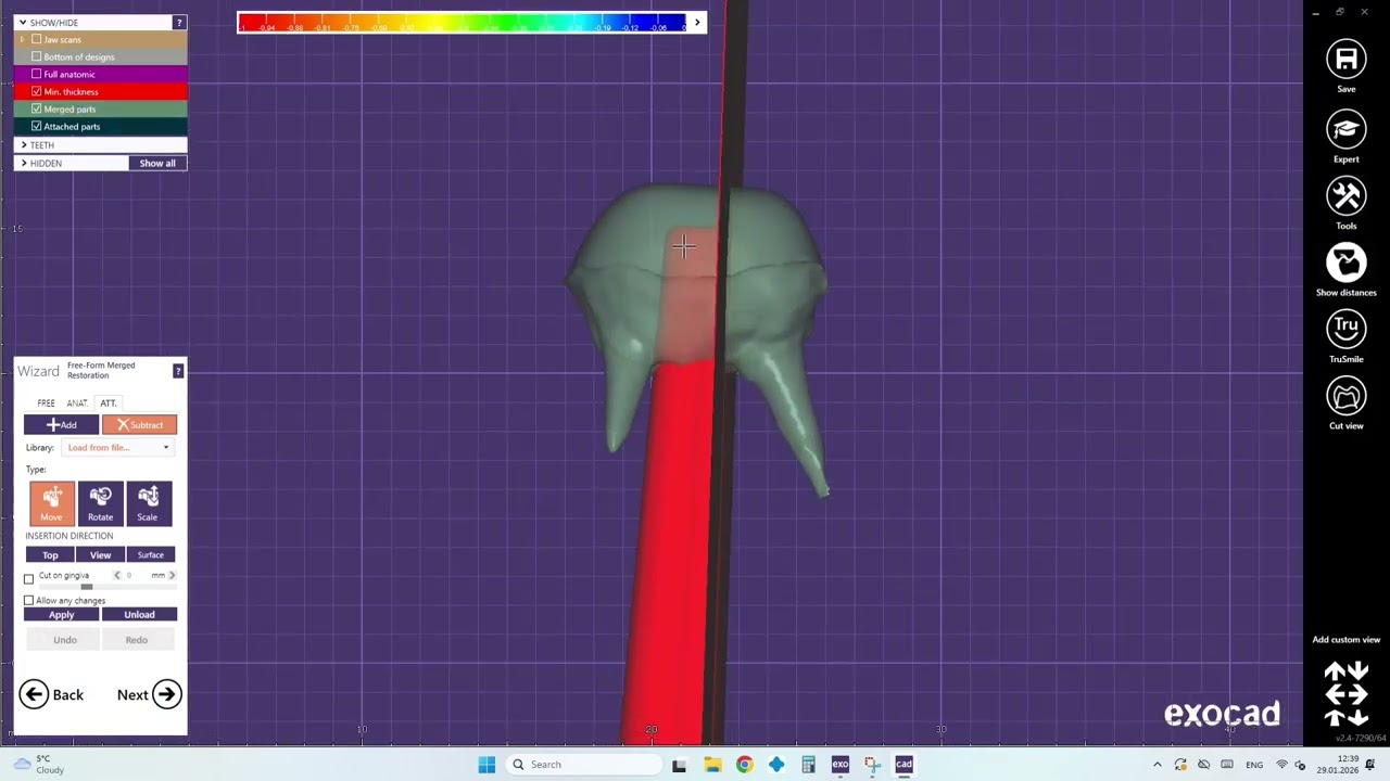 How to design two pieces of inlay/onlay in exocad