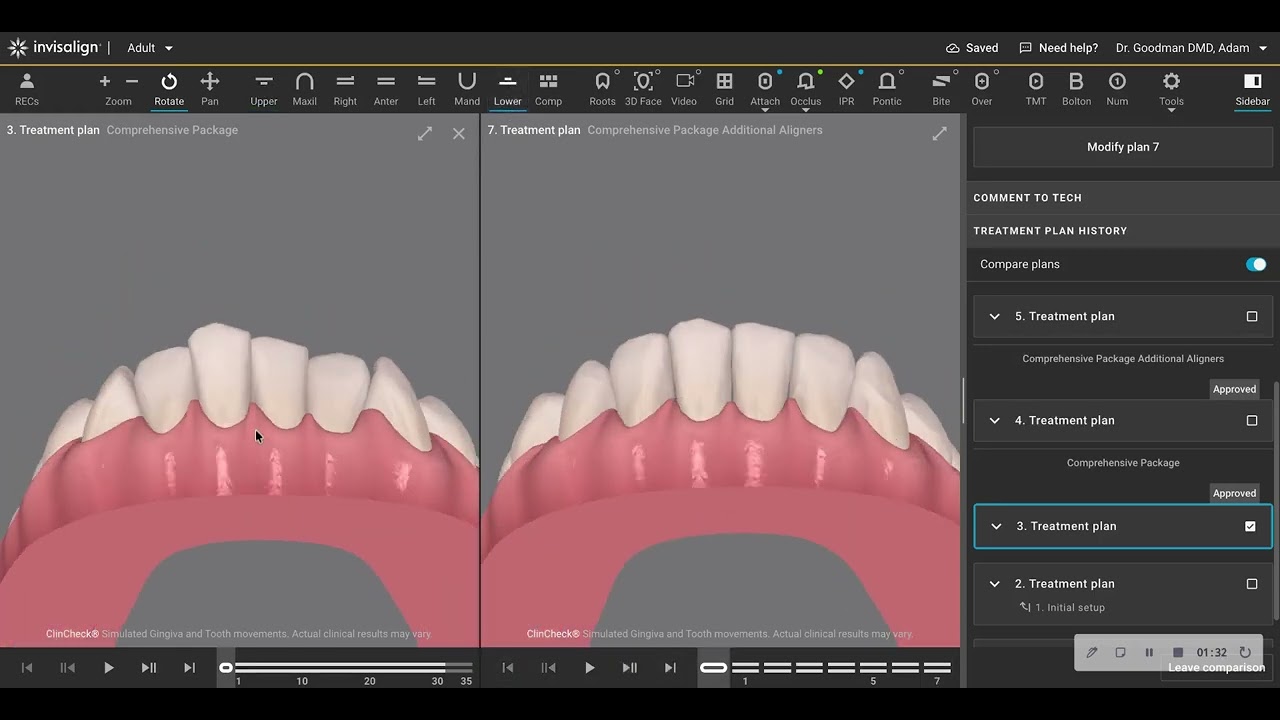 Invisalign Treatment Cost and Duration Related to Degree of Treatment Correction in the End Stage