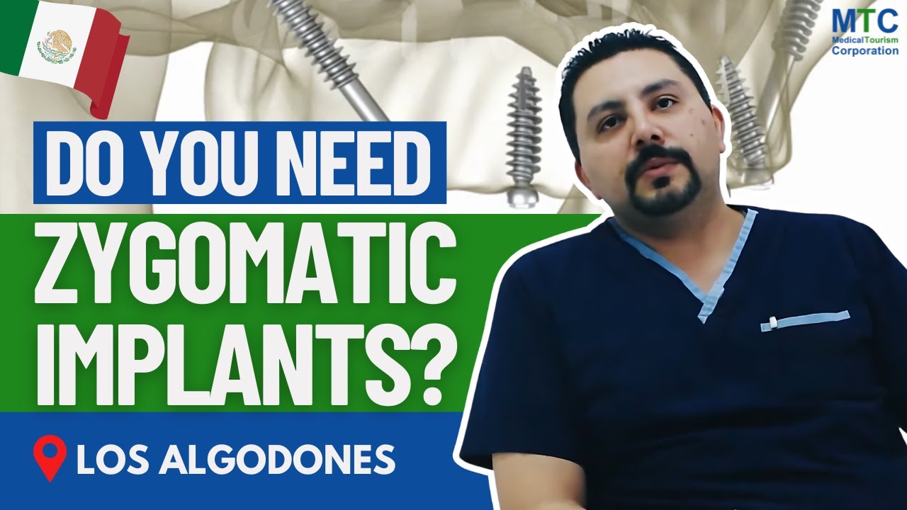 Zygomatic Implants at Sani Dental Group in Los Algodones – Mexico | Near Yuma, AZ
