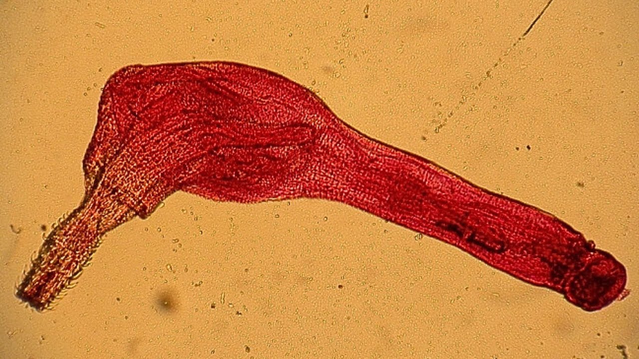 Filo Rotifera – Parte 3: Subclado Acantocephala (Vermes-parasitas-de-cabeça-espinhosa).