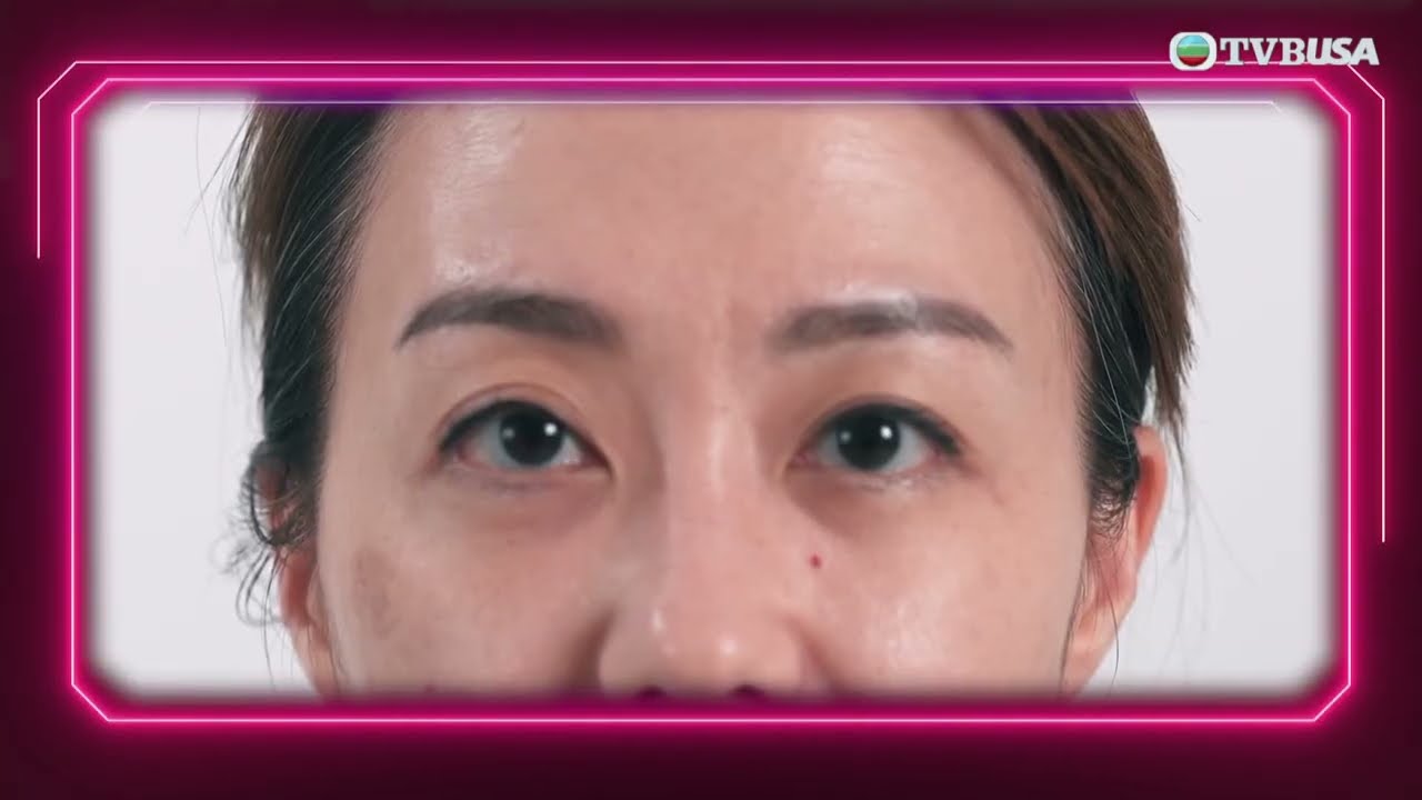 醫美直擊 首爾篇｜翠欣體驗激光去斑機　對付荷爾蒙斑兼促進皮膚再生　韓國醫生揭療程關鍵｜何依婷｜韓國｜醫美
