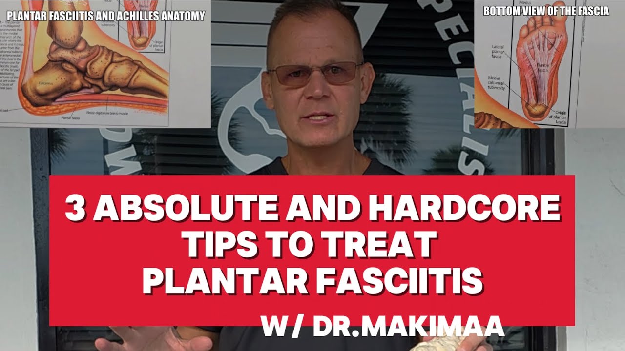 3 Hardcore and Absolute Tips to Treat your heel pain caused by Plantar Fasciitis see 👇 