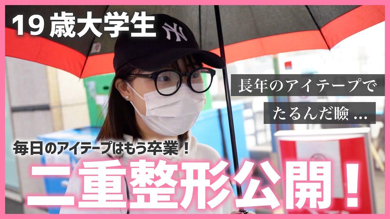 【二重整形・埋没法のリアル第7弾】長年のアイテープでとても伸びてしまったまぶたでも、埋没法で綺麗な二重は作れるのか！？二重整形のカウンセリング〜手術〜完成まで全て大公開！！【解説付き】