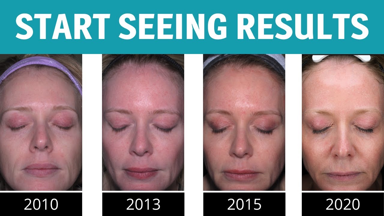 TNS Serum Update | Upgrade Your Skincare Routine