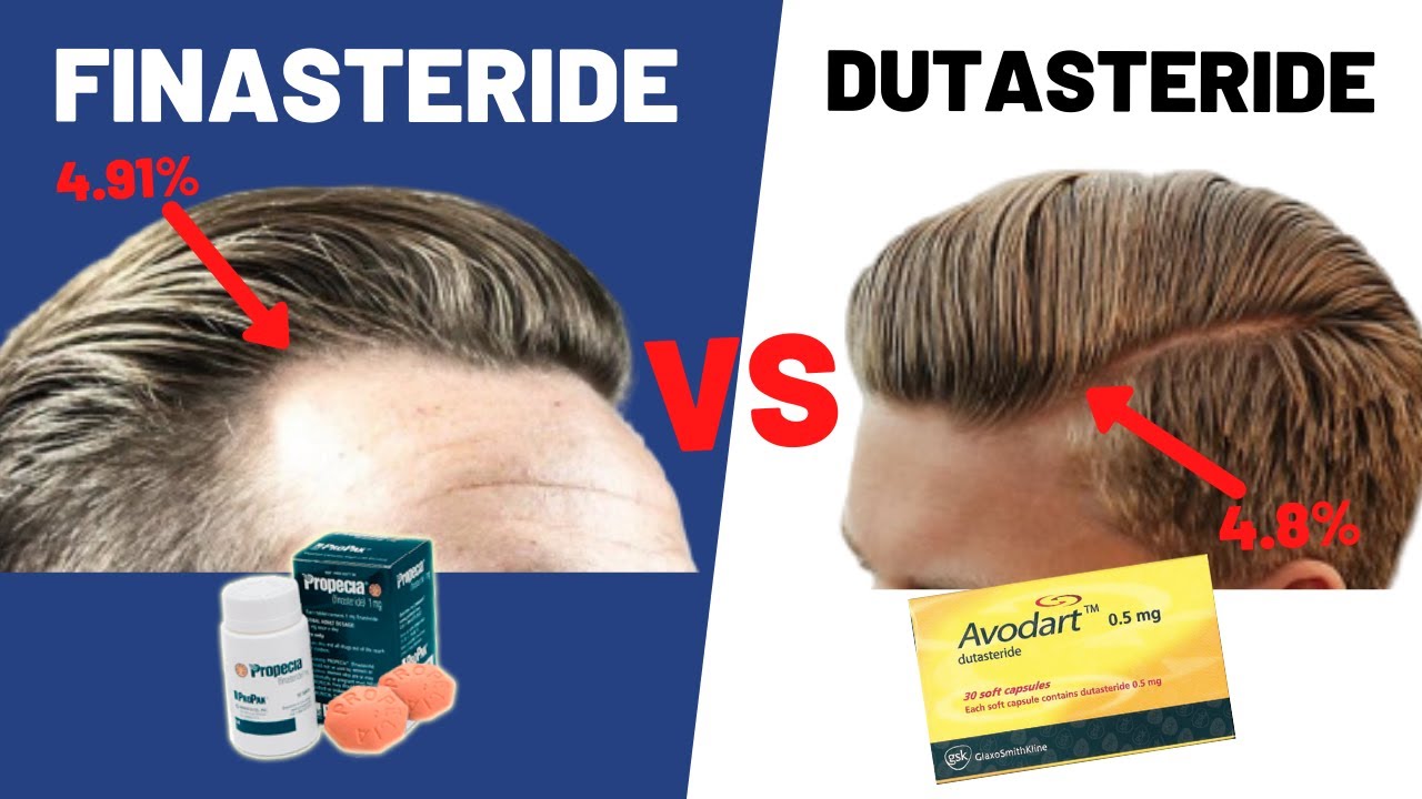 Dutasteride VS Finasteride - Which Is BETTER For Your Hair Growth?