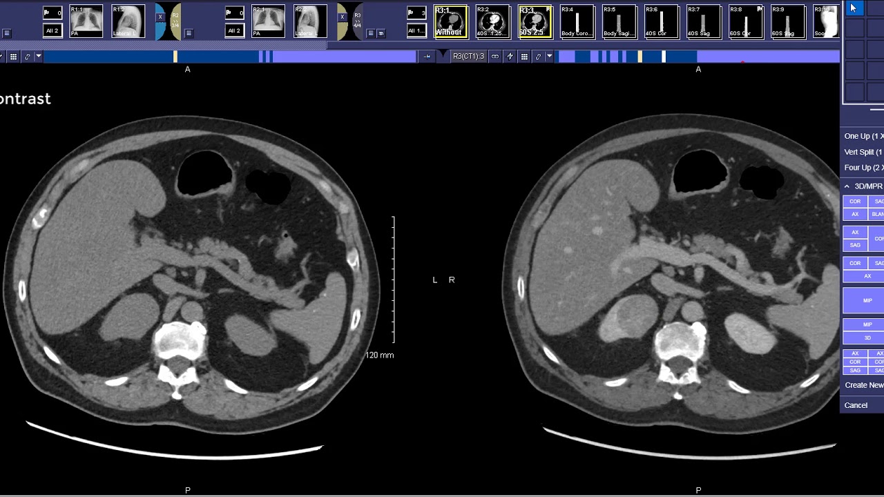 How to read a Renal Mass CT