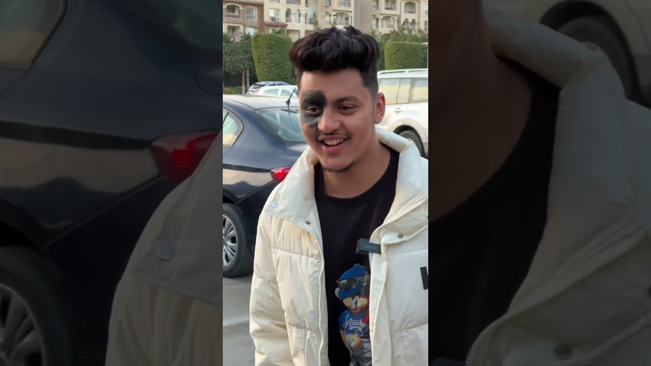 الوحمه والجامعة