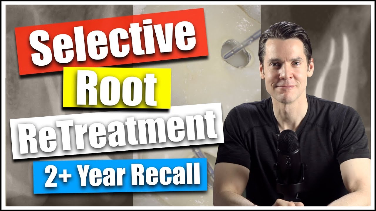 Selective Root Canal Retreatment #3, CBCT Scan, Percision Access, Dr William Nudera, Endodontist 003