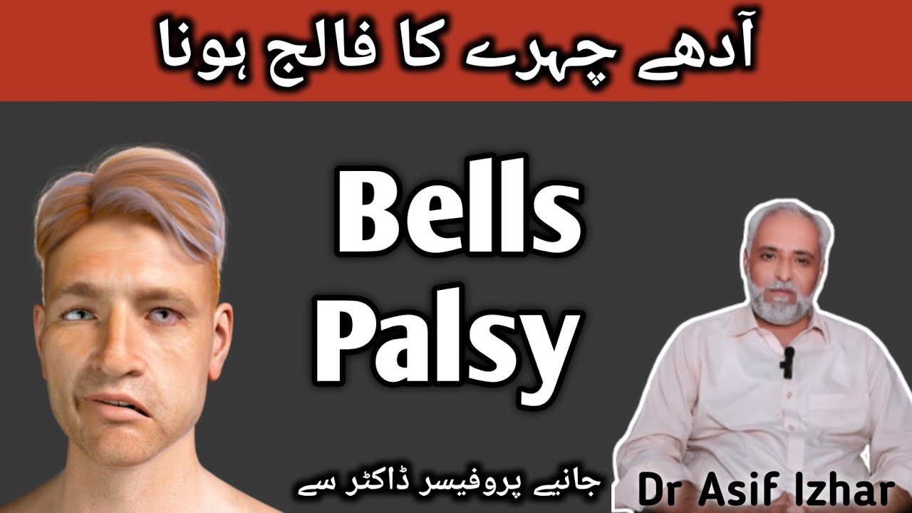 Bell's Palsy Treatment In Urdu | Adhe Chehre Ka Falij Hona | Facial Paralysis Treatment In Urdu