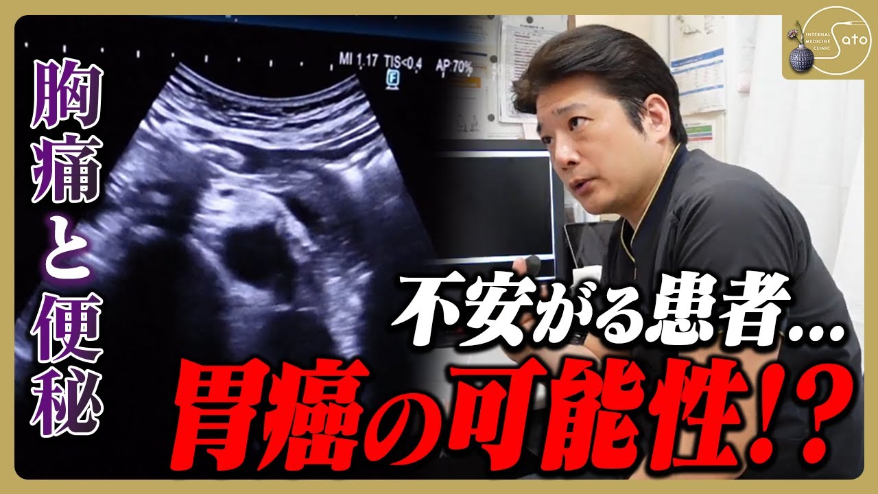 『胃癌じゃないですか！？』不安がる患者に寄り添う医師... 検査の答えは胃腸障害？