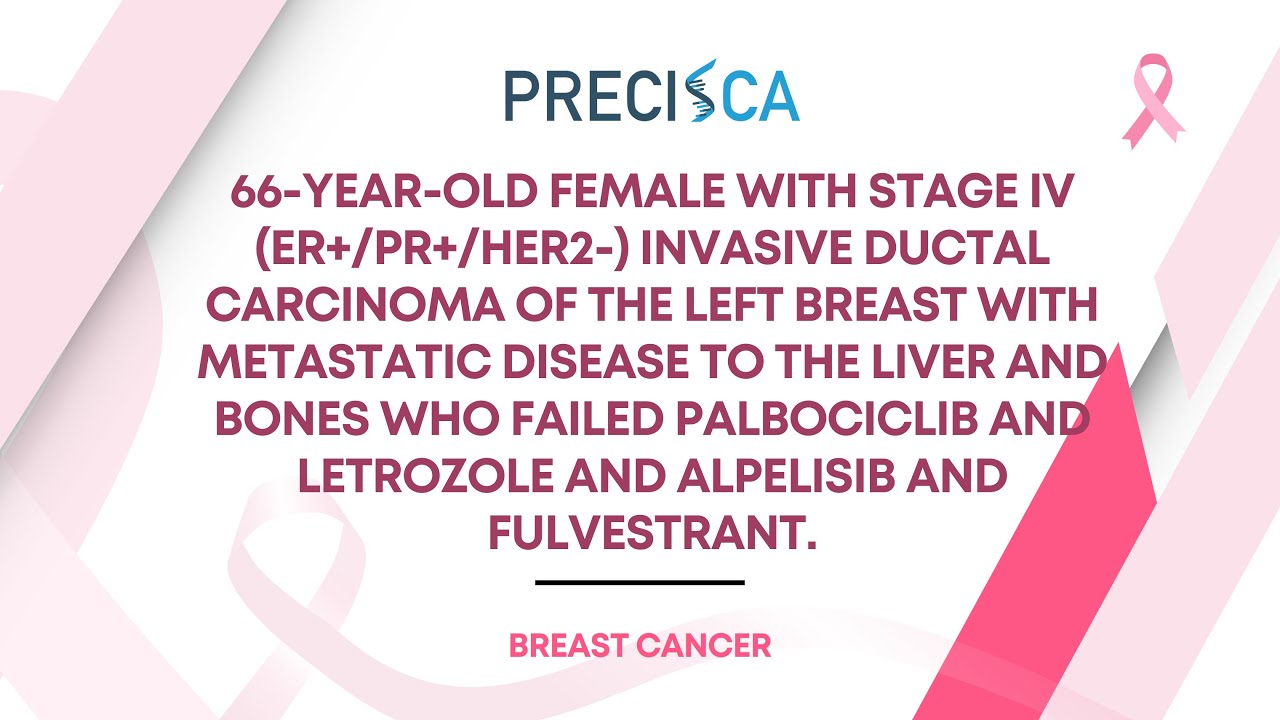 Expert Cancer Panel: Stage IV IDC w/ metastases s/p palbociclib/letrozole and alpelisib/fulvestrant