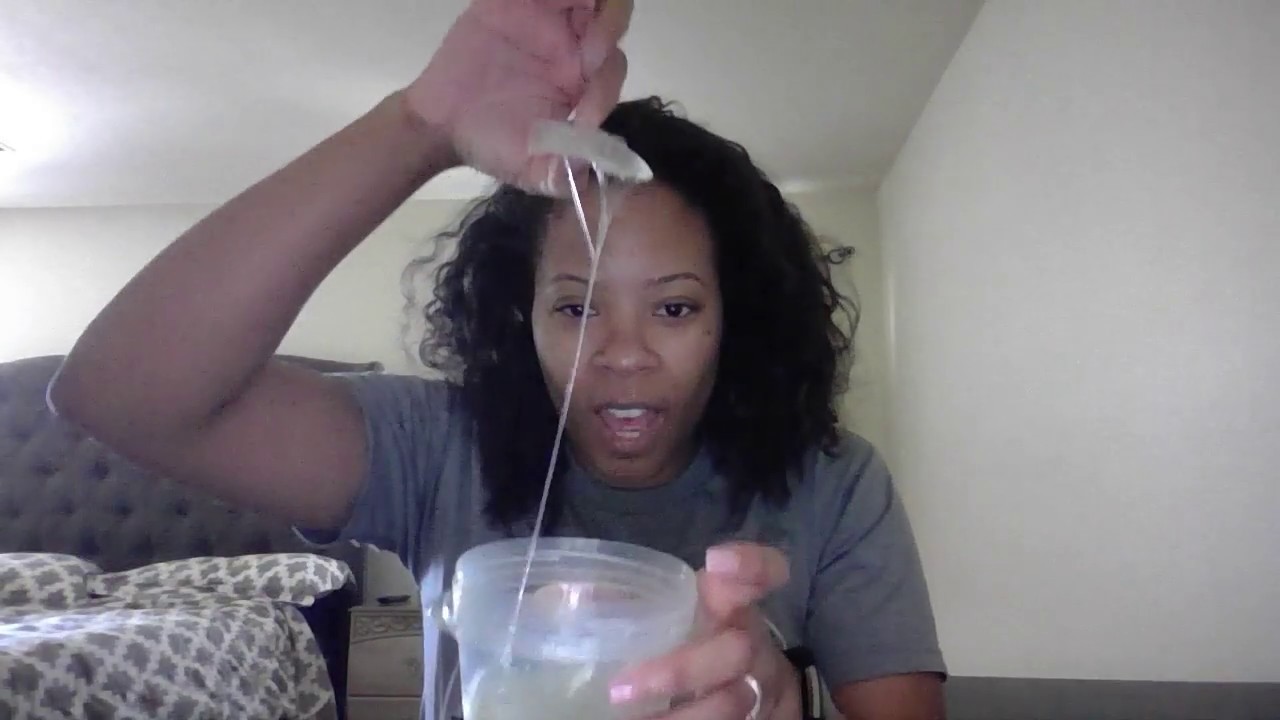 How I use ALOE VERA for my Seborrheic Dermatitis (Face and Scalp)