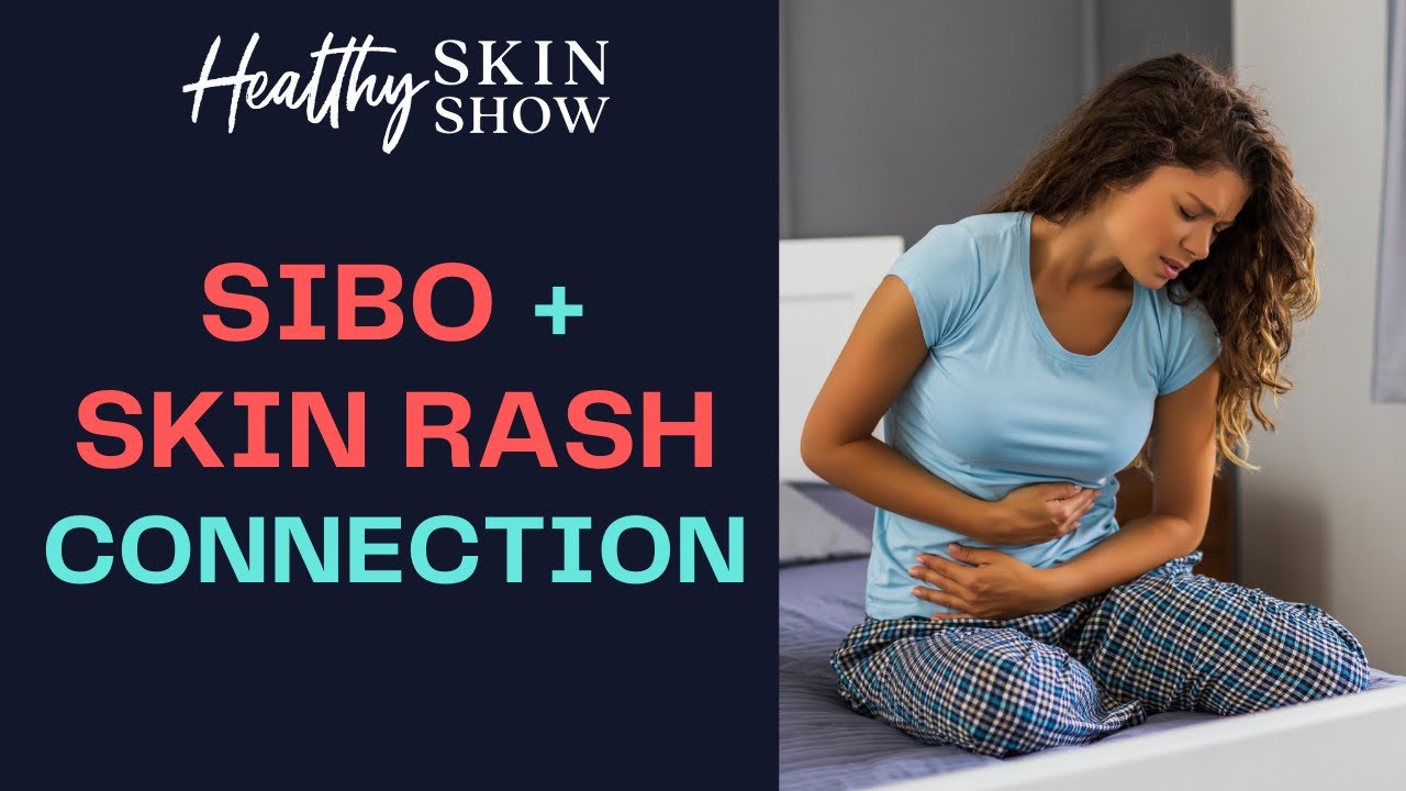 SIBO-Skin Rash Connection | Amy Hollenkamp