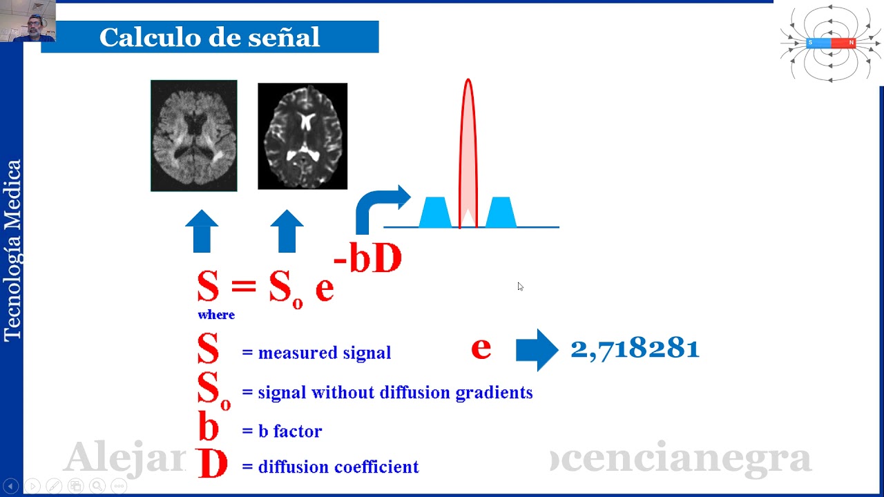 07- Difusión por RMI: Principios básicos de la técnica DWI