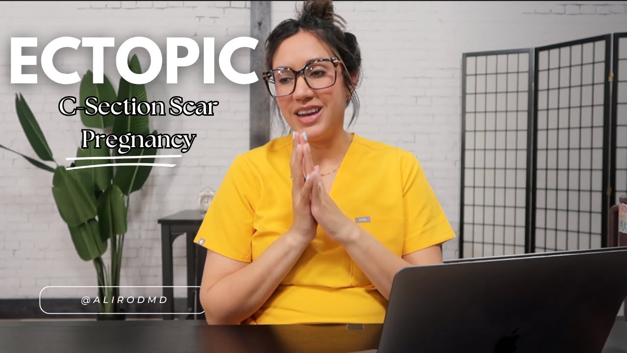 ECTOPIC PREGNANCY ON A C-SECTION SCAR?! | Dr. Ali Explains it all!