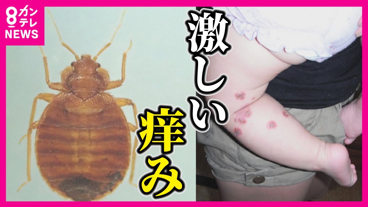 【「進化」殺虫剤も効かぬ】「スーパートコジラミ」の脅威　猛烈なかゆみ　高い繁殖力　駆除にかかる費用は10万円以上が相場（1部屋・30平米）トコジラミの好きなモノ　ベッドの周辺　クローゼット
