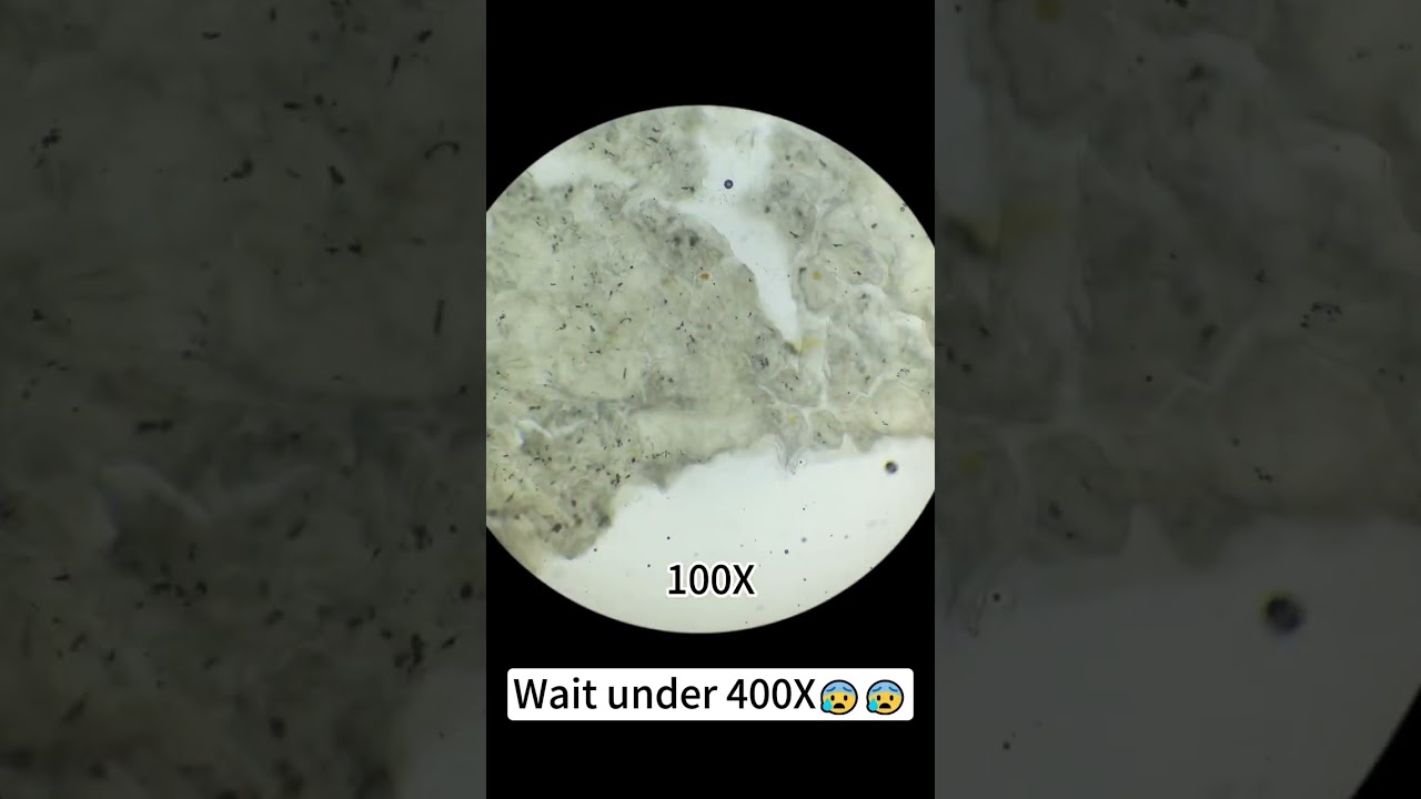 Honey magnified 400X is really cool!#microscope #underthemicroscope