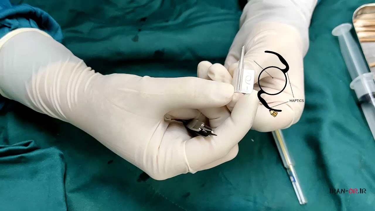 IOL injection for Cataract Surgery آموزش قراردادن لنز داخل چشمی در اینجکتور برای جراحی کاتاراکت