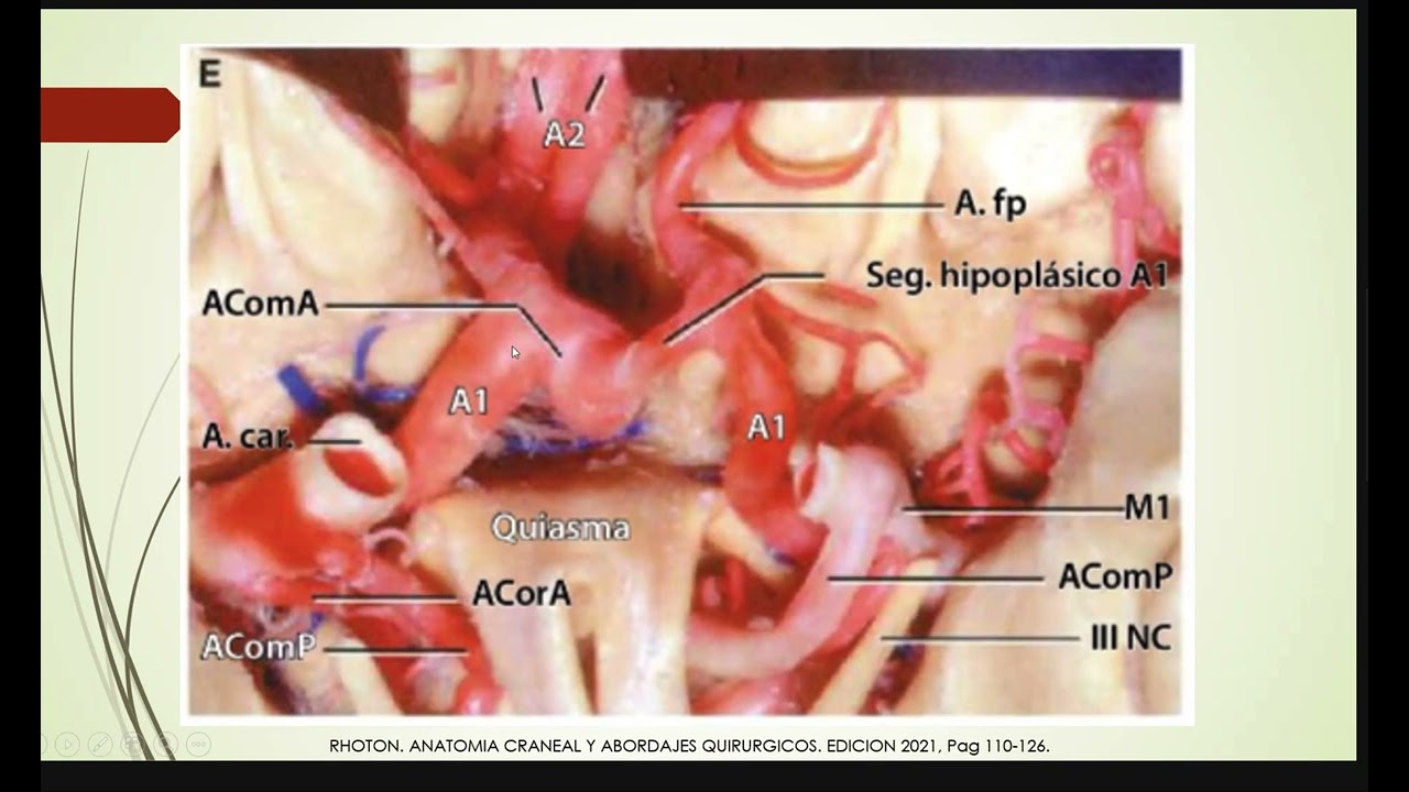 ARTERIA CEREBRAL ANTERIOR - ANATOMIA