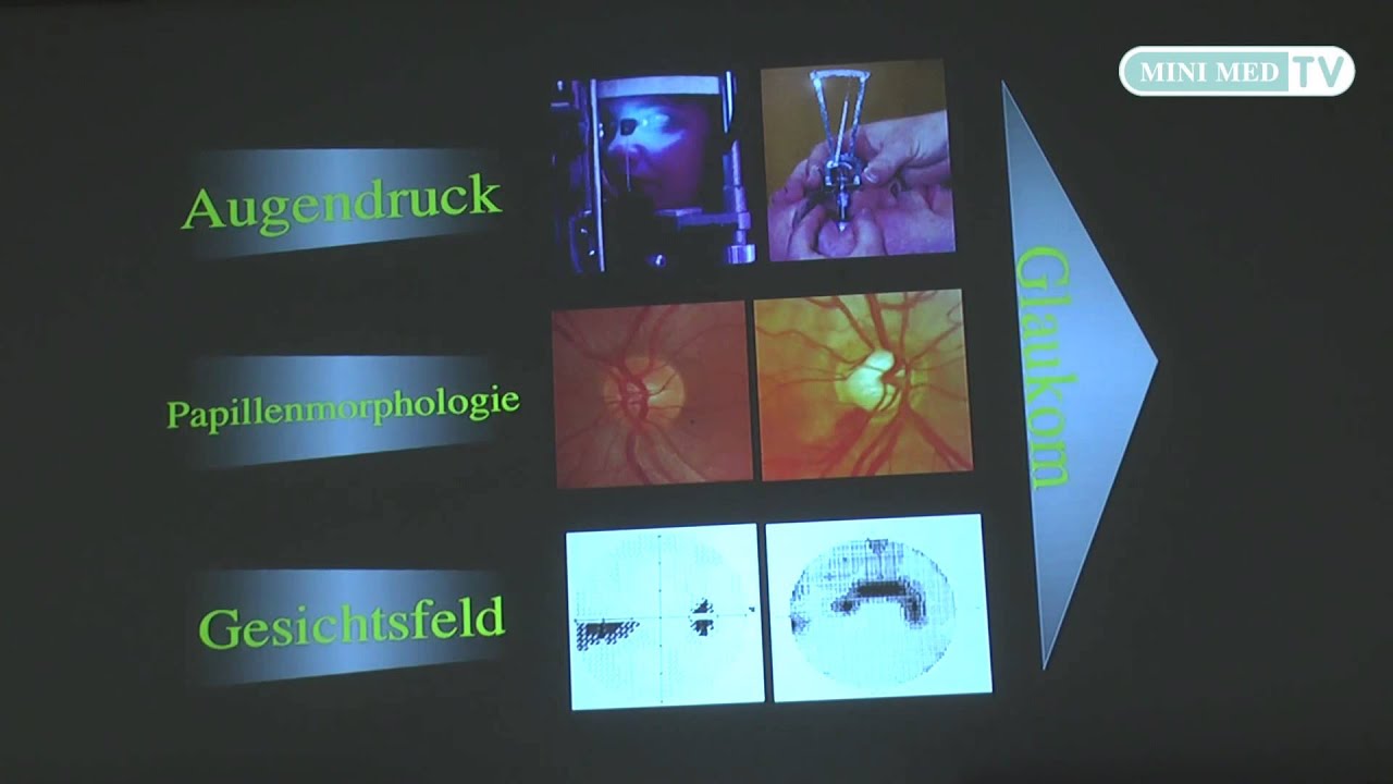 Augenerkrankungen - MINI MED Studium mit Univ.-Prof. Dr. Nikolaos Bechrakis