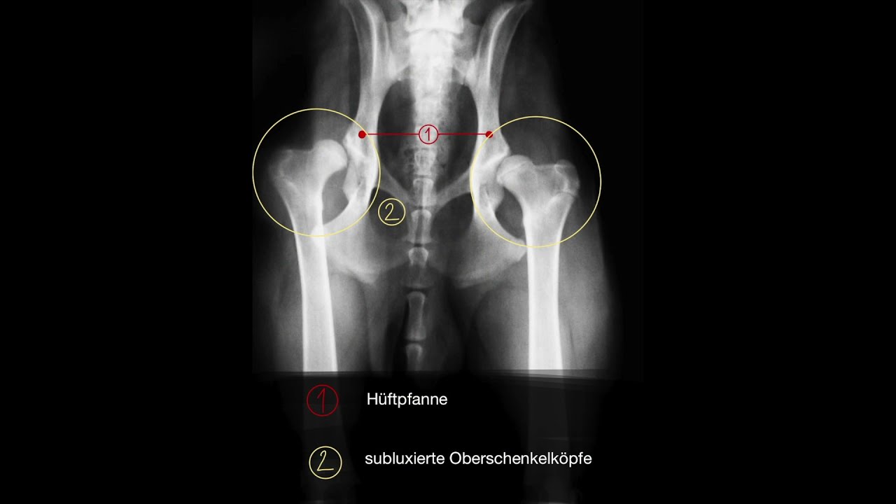 Goldimplantation bei Titus: Freude an Bewegung trotz massiver Hüftgelenksdysplasie (HD)