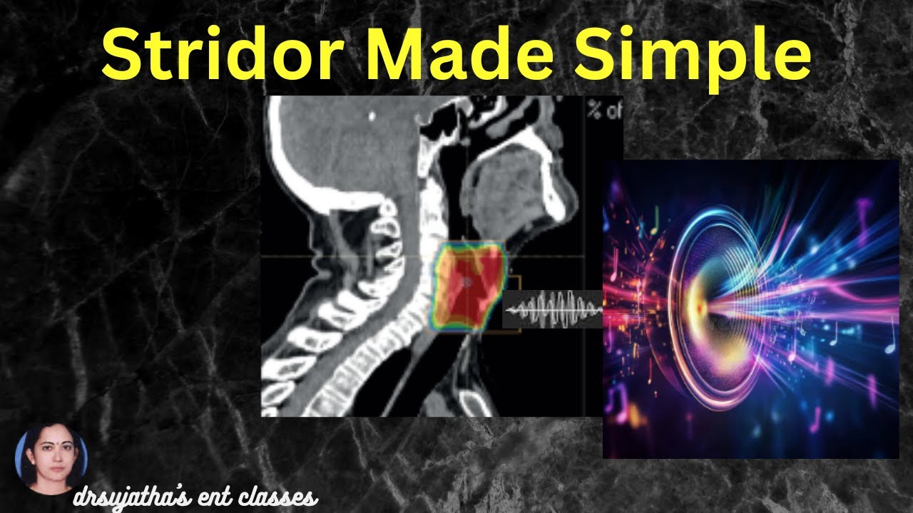 269. Stridor Made Simple: Causes, Diagnosis & Management | How to Differentiate Types of Stridor