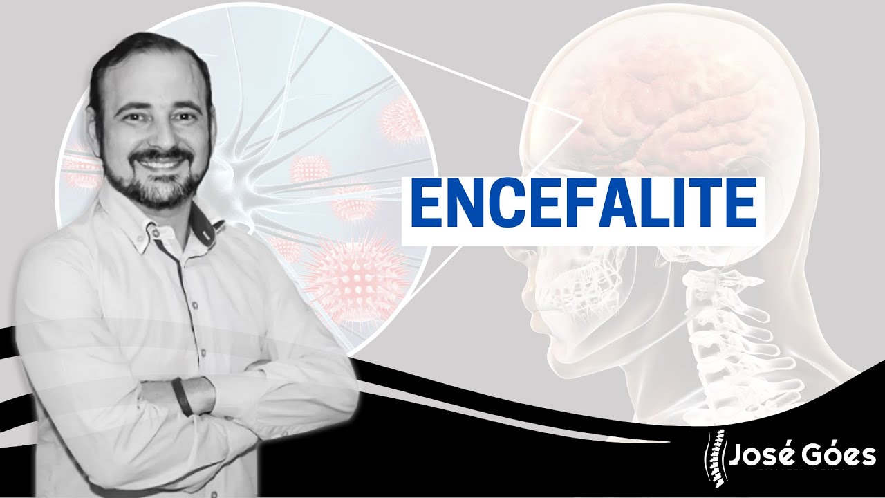 Encefalite | José Góes