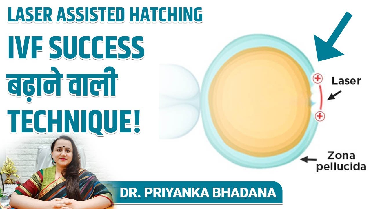 What is Laser Assisted Hatching in IVF? 🔬🧫
