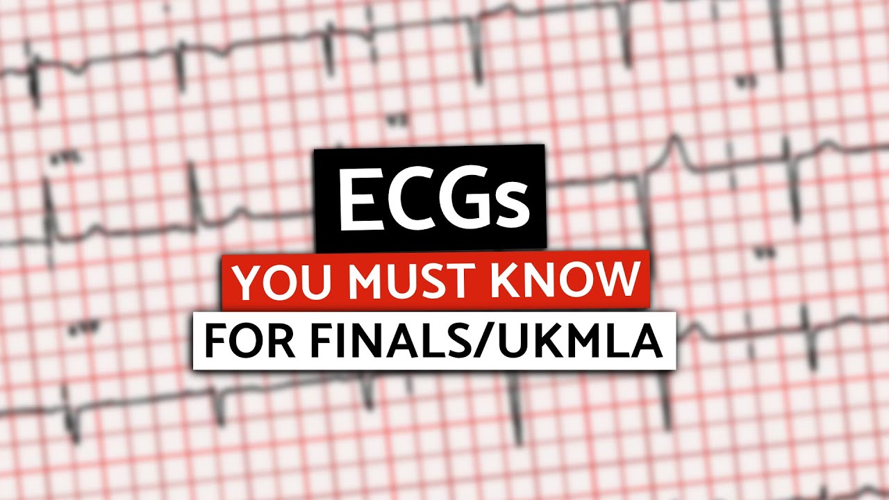 MUST KNOW ECGs for Med School Finals/UKMLA/PLAB | Rapid High-Yield ECGs